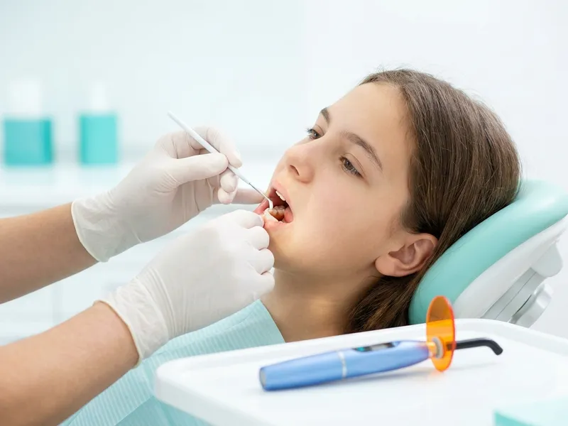 Dental Sealants