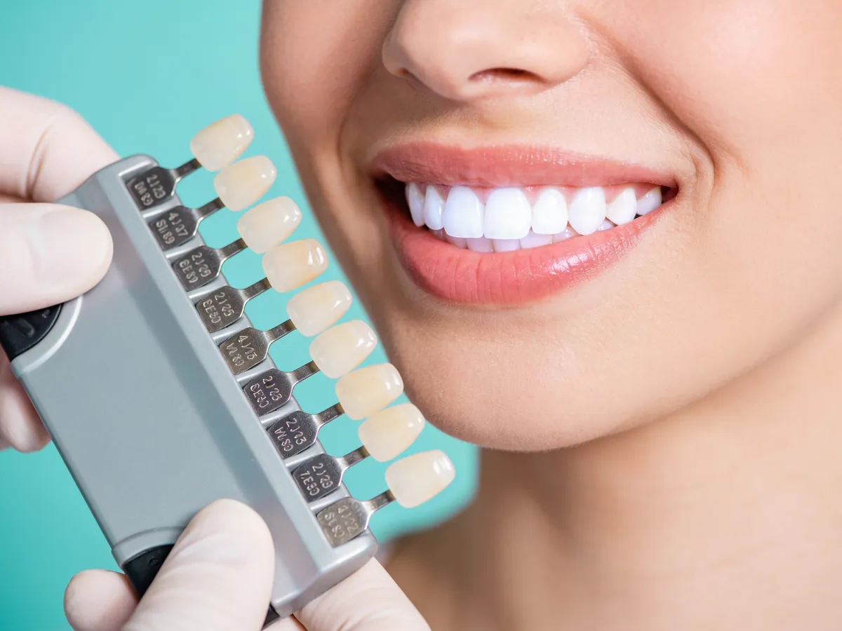 Teeth Whitening